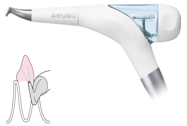 パウダーポリッシング AIR FLOW ハンディ